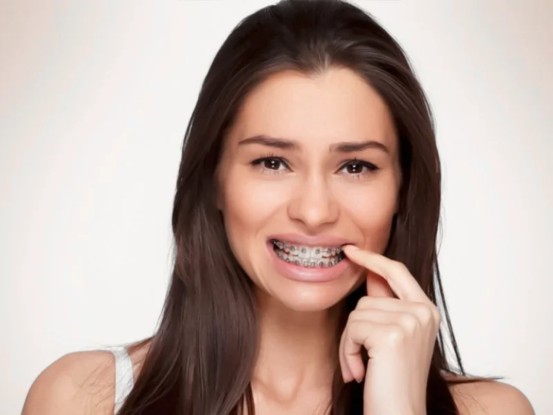 Cuidados con aparatos de ortodoncia