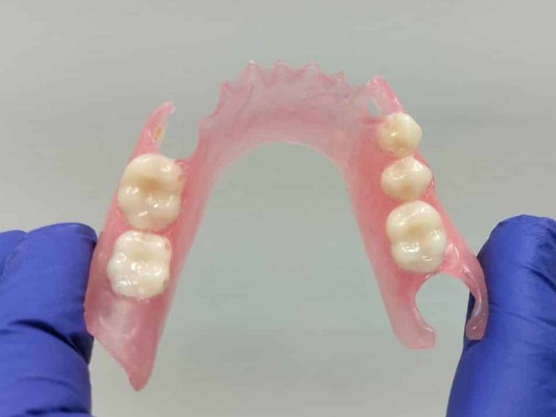Prótesis dentales removibles