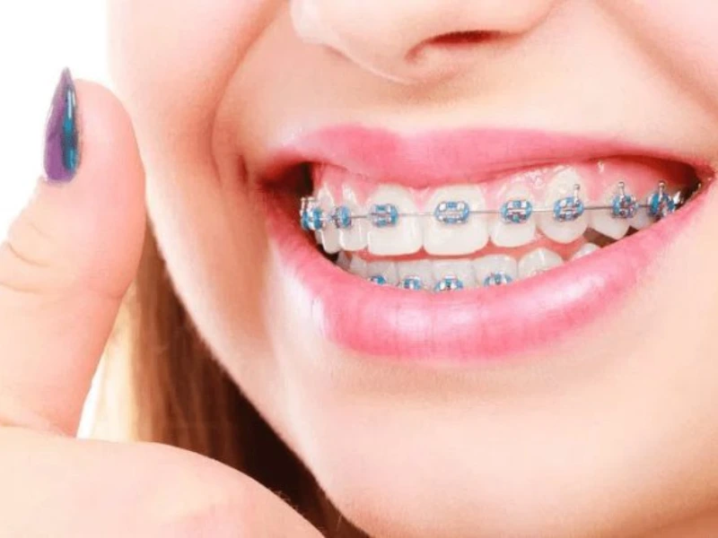 Importancia de la ortodoncia